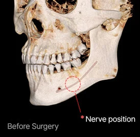 Surgery illustration