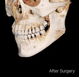 Surgery illustration