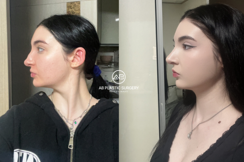 The Best English-Speaking Plastic Surgery in Seoul, South Korea
