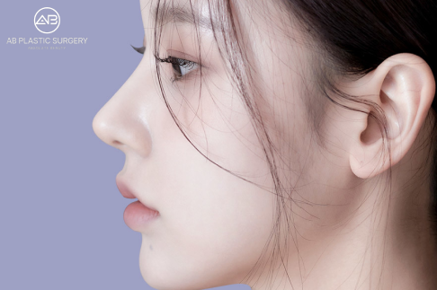 Hawk Nose: Causes, Correction Options & Before-After Results | AB Plastic Surgery