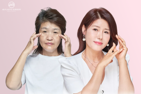 Endotine Lift in Korea: Surgical Lifting Options, Indications, and Recovery Guide
