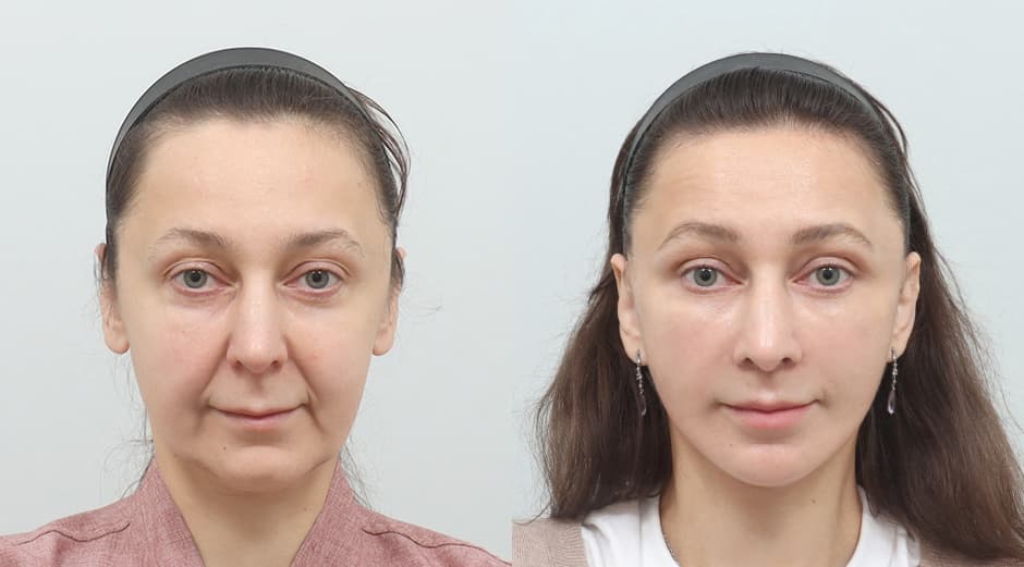 AB Plastic Surgery