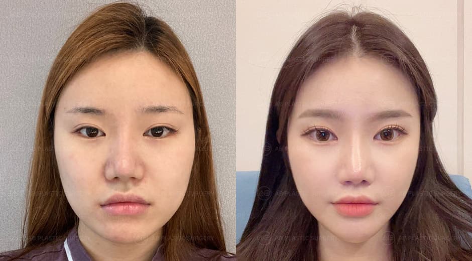 I had surgery at AB Plastic Surgery, and now I'm working there as an employee.