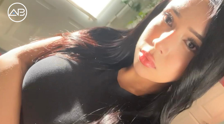 My Journey with Facial Feminization Surgery at AB
