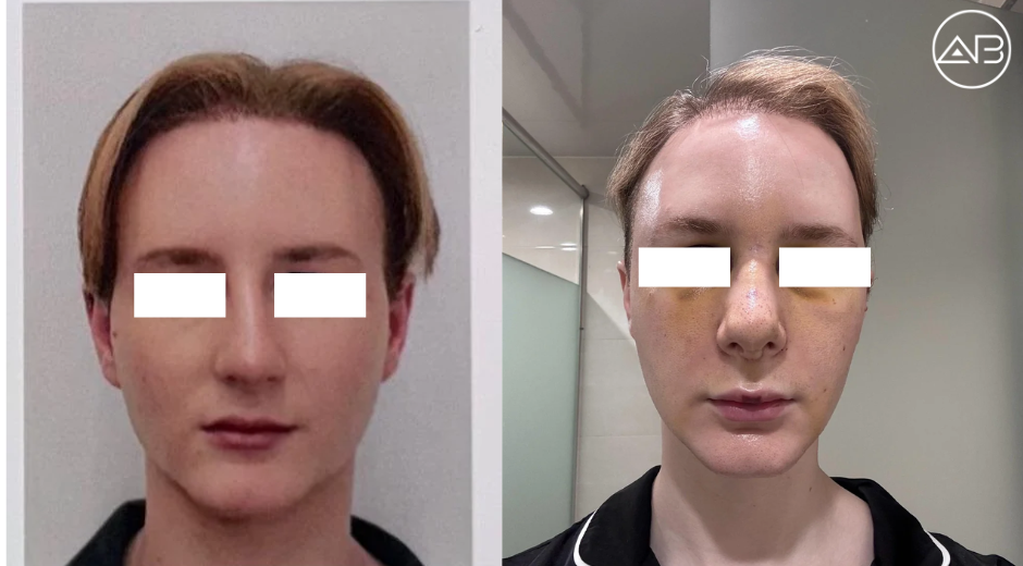 AB Plastic Surgery Review