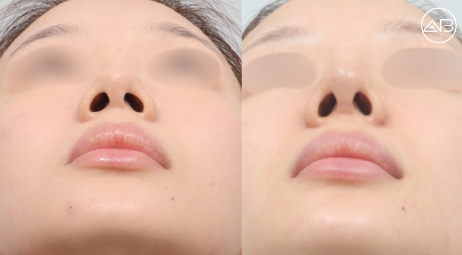 My nose turned out exactly how I imagined